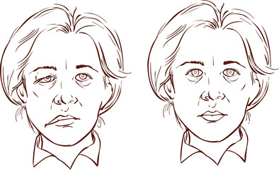 how to fix asymmetrical face