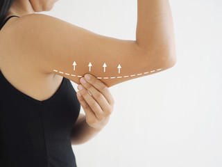 how to get rid of cellulite on arms